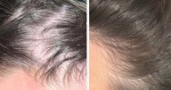 Woman, 53, thought she ruined her hair forever until she found 65p