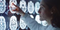 Día Mundial de la Parálisis Cerebral: cinco recomendaciones clave para acompañar a los pacientes