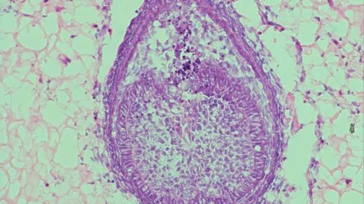 Scientists are racing to grow human teeth in the lab