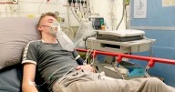 Man has legs amputated after sepsis gets mistaken for flu
