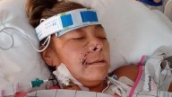 Oklahoma dog attack: Janelle Scott has all four limbs amputated after vicious mauling in US