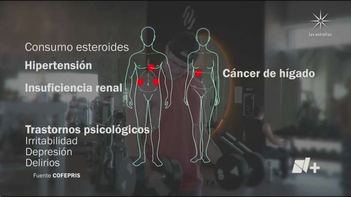 Consecuencias de Usar Esteroides Anabólicos: de Insuficiencia Renal a Trastornos Psicológicos