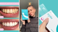 Dentist-approved at-home teeth whitening kit shoppers swear by for gleaming results announces flash sale