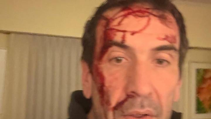 Asaltan y golpean a Pablo Cervi, el candidato de LLA en Neuquén