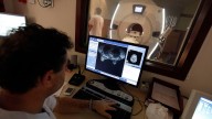 Un informe de Sanidad ve "conveniente reducir" el envío de 18.893 resonancias por cáncer de la Fe y el Clínico a la privada