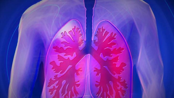 Galicia extiende a toda la comunidad el cribado de cáncer de pulmón