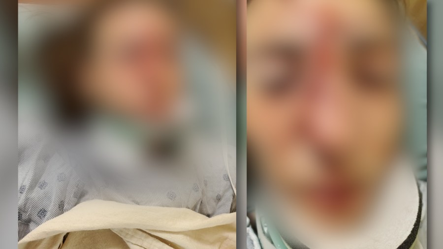 Community supports Hampton family after teen gets hit by car while riding bike to school