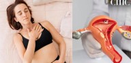 ¿Cómo es vivir 24 horas diarias con una dolorosa endometriosis? Relato de joven que pidió eutanasia