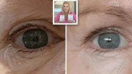 Celebrity-loved $29 eye cream with more than 1,500 glowing reviews is wowing shoppers with its ability to banish dark circles