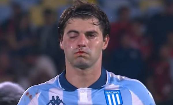 Dolor en Racing por el parte médico de Sosa tras el golpazo de Rojo