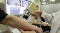 La comarca del Caudal incorpora la IA para identificar lesiones dermatológicas en sus centros de salud