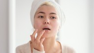 Dry, Cracked Lips? Here’s How To Heal Them Naturally