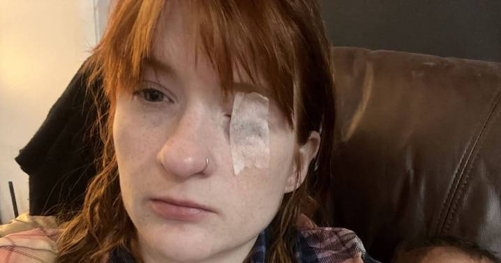 Mum drinking tea realised face had become paralysed – now she tapes eye shut to sleep