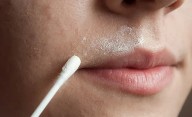 ¿Es posible eliminar vello de la cara de manera natural?
