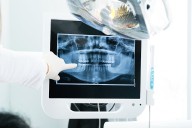 ¿La caries avanza o se detiene? Cómo evitar que despierten las lesiones inactivas