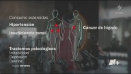 Consecuencias de Usar Esteroides Anabólicos: de Insuficiencia Renal a Trastornos Psicológicos