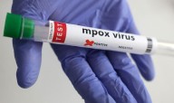 Namibia's health ministry declares outbreak of Mpox in Swakopmund