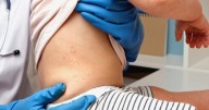 Declining vaccine rates fuel measles outbreak in South Carolina