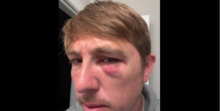 Man says he was beaten by biker in ‘random act of violence’ on Staten Island