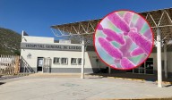 ¿Qué es la Klebsiella Pneumoniae, la bacteria que se presentó en el Hospital General de Lerdo?