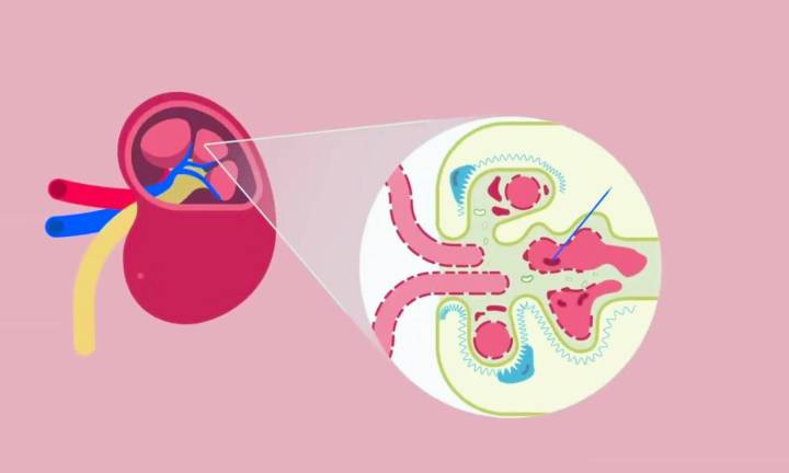 Telitacicept Effectively Reduces Proteinuria in IgA Nephropathy with Safe Tolerability: Study