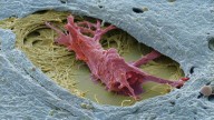 Tubulis raises $358 million to advance cancer treatments