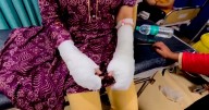 Major twist in Delhi acid attack case as victim’s father confesses to staging assault: Report