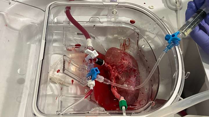 España da un paso histórico en medicina regenerativa: logran combinar minirriñones humanos con órganos de cerdo