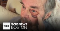 Cape Cod man attacked after “No Kings” protest