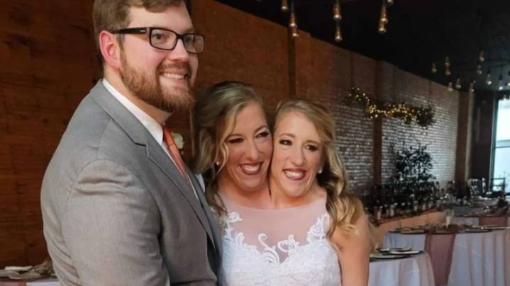 Weird Things About Abby Hensel And Josh Bowling's Marriage We Can't Ignore