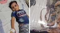 MP Bizarre: Family Takes Snake To Hospital For Venom Test After It Bites 5