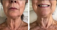 The £23 cream that 'smooths out neck wrinkles' so well one sells every 30 seconds