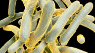 TB exposure reported at Chula Vista’s Innovation High School