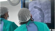 Cardiopatías congénitas: el Hospital Alassia concretó las dos primeras intervenciones con el nuevo angiógrafo