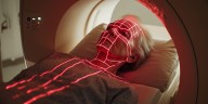 Por qué las mujeres tienen mayor riesgo de desarrollar enfermedad de Alzheimer y esclerosis múltiple