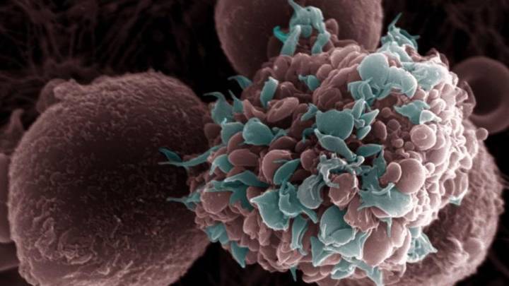 Un fármaco ‘made in Spain’ mejora la supervivencia y reduce las recaídas del cáncer de mama