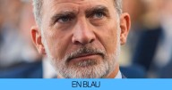 Felipe VI padece un trastorno que desencadena importantes problemas de higiene