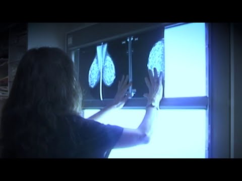 How some U.S. women are shut out of a breast cancer treatment, IORT, valued around the world