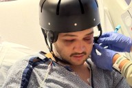 ‘An absolute nightmare’: Dedham man suffers brain injury after assault near Fenway Park, his mother says