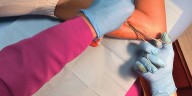 Jornada de implantes en el Hospital Rovirosa