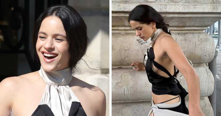 Pop Star Dyes Her Armpit Hair At Paris Fashion Week, Sparking Mixed Reactions: “Chicken Feathers”