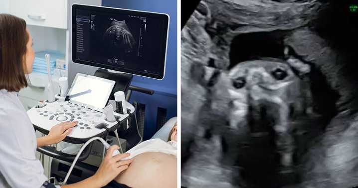 Pregnant Woman’s Sonogram Image Goes Viral After She Spots Hilarious Detail