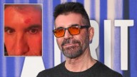 Simon Cowell pulled out of Britain’s Got Talent auditions ‘after suffering head injury’