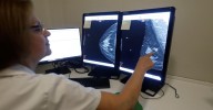El PSOE exige al Ayuntamiento de Almuñécar que "mire por las mujeres" afectadas por los fallos en el cribado de cáncer de mama