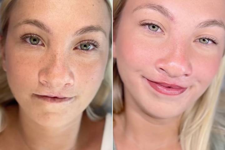 Woman, 24, Underwent 20 Surgeries for Her Cleft Lip. This Tattoo Changed Everything (Exclusive)