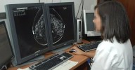 La Asociación Española Contra el Cáncer ante los problemas de cribado:  "No tenemos información sobre el alcance"