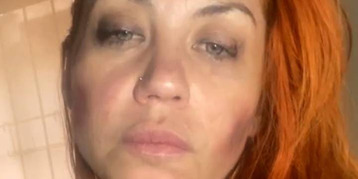 Los antecedentes de violencia de género: Lourdes de Bandana había denunciado dos veces a su pareja