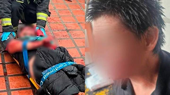 La Plata: dos hombres resultaron heridos en una violenta pelea a cuchillazos