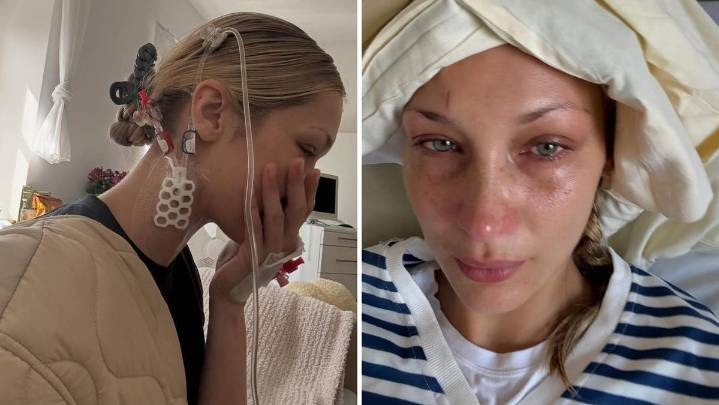Bella Hadid in hospital for treatment of Lyme disease