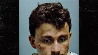 Connecticut Man Allegedly Murders Mother, Sports Scratched Face in Mug Shot
